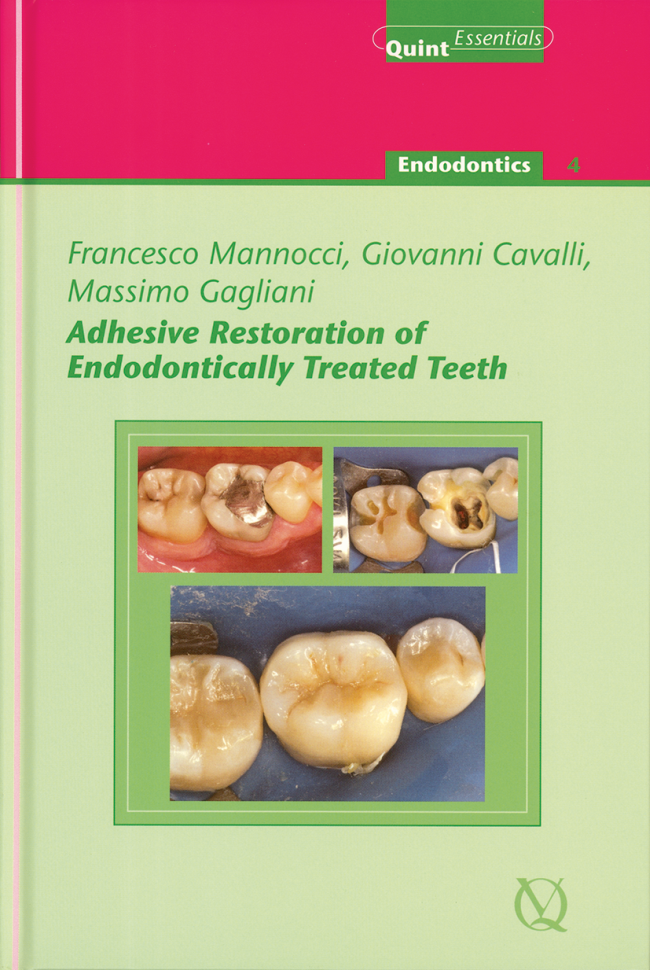 Mannocci: Adhesive Restoration of Endodontically Treated Teeth
