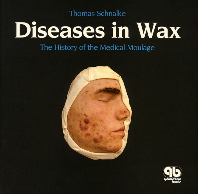 Schnalke: Diseases in Wax