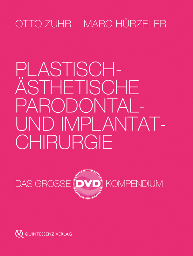 Zuhr: Plastisch-ästhetische Parodontal- und Implantatchirurgie