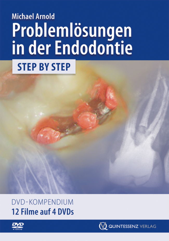 Arnold: Problemlösungen in der Endodontie