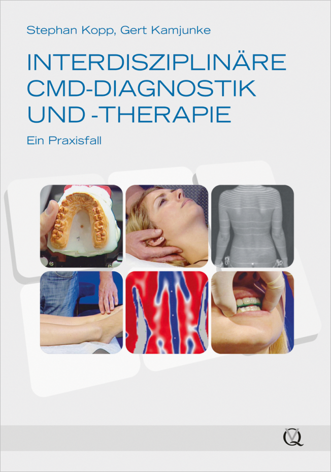 Kopp: Interdisziplinäre CMD-Diagnostik und -Therapie
