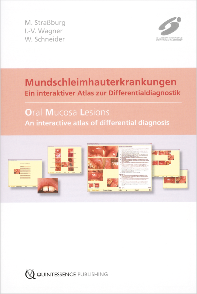 Straßburg: Mundschleimhauterkrankungen / DS OML—Oral Mucora Lesions