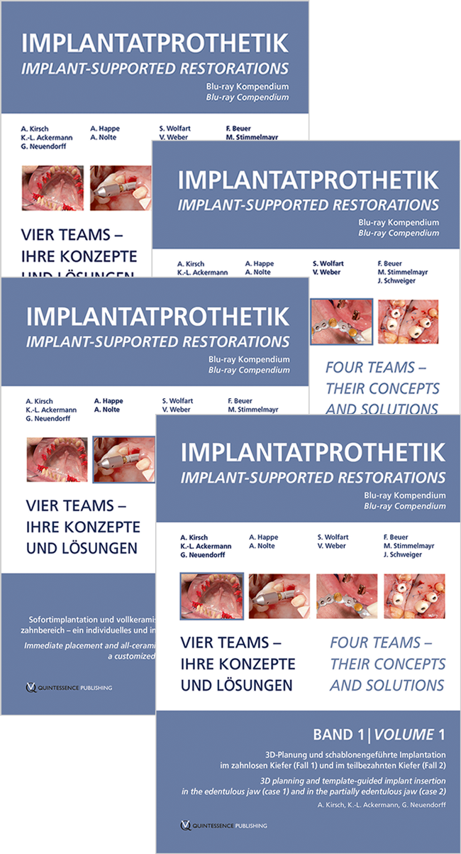 Kirsch: Implantatprothetik / Implant-supported restorations