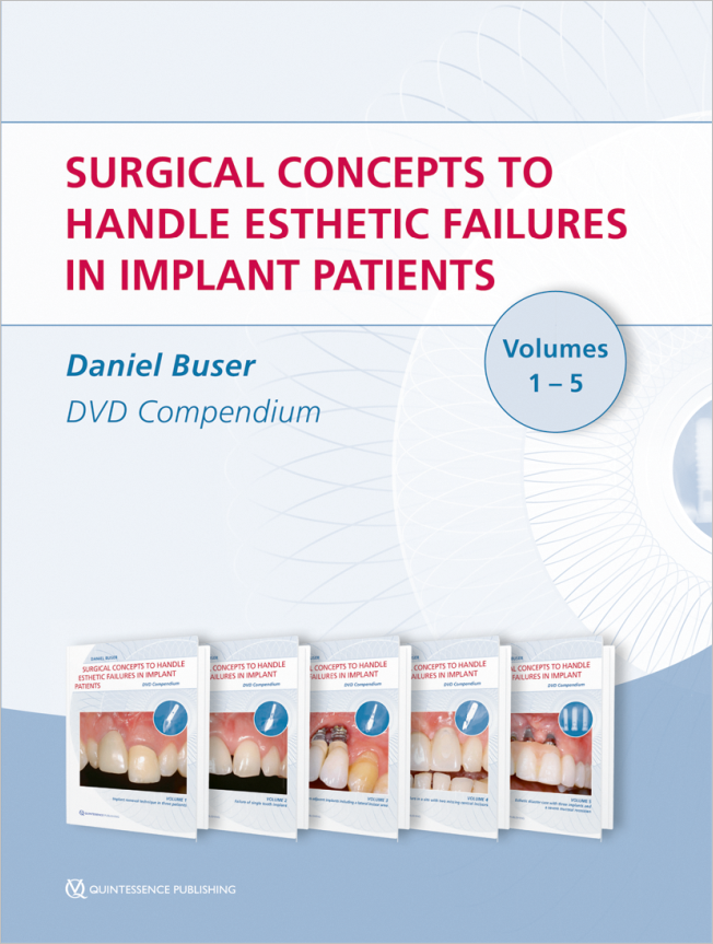 Buser: Surgical concepts to handle esthetic failures in implant patients