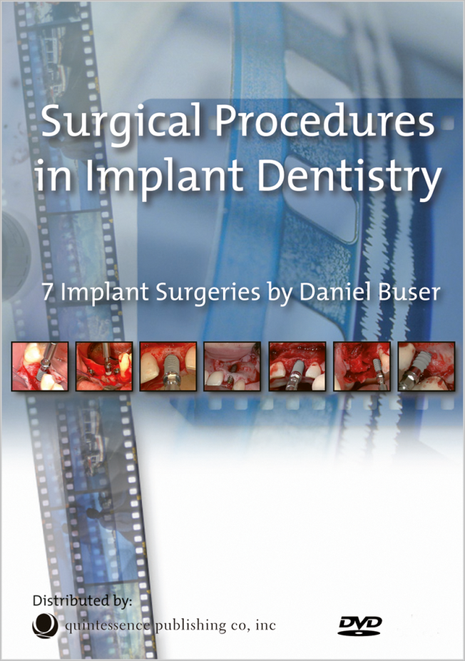 Buser: Surgical Procedures in Implant Dentistry