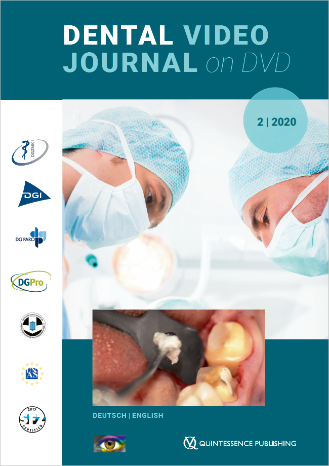 (DGZMK): Dental Video Journal 2/2020
