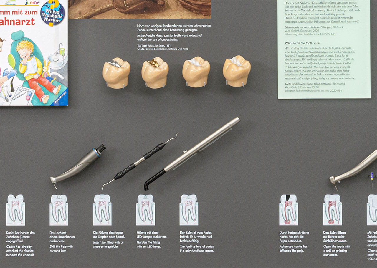 Die vier 3D-gedruckten Zahnmodelle zeigen die unterschiedlichen Füllungsmaterialien. Darunter ist zudem die Voco-Polymerisationslampe Celalux ausgestellt. Bild: Voco